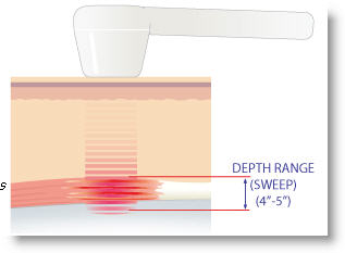 LaserPrism Cold Laser Therapy