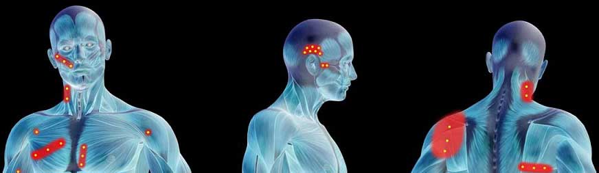 What is Laser Therapy