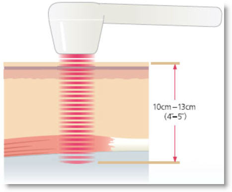 Pain Treatment